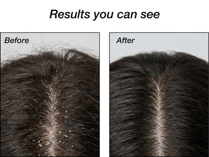 ZP11 + Argan Oil Anti-Dandruff Shampoo
