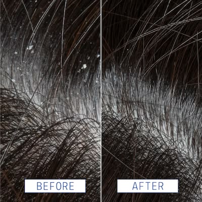 ZP11 + Argan Oil Anti-Dandruff Shampoo