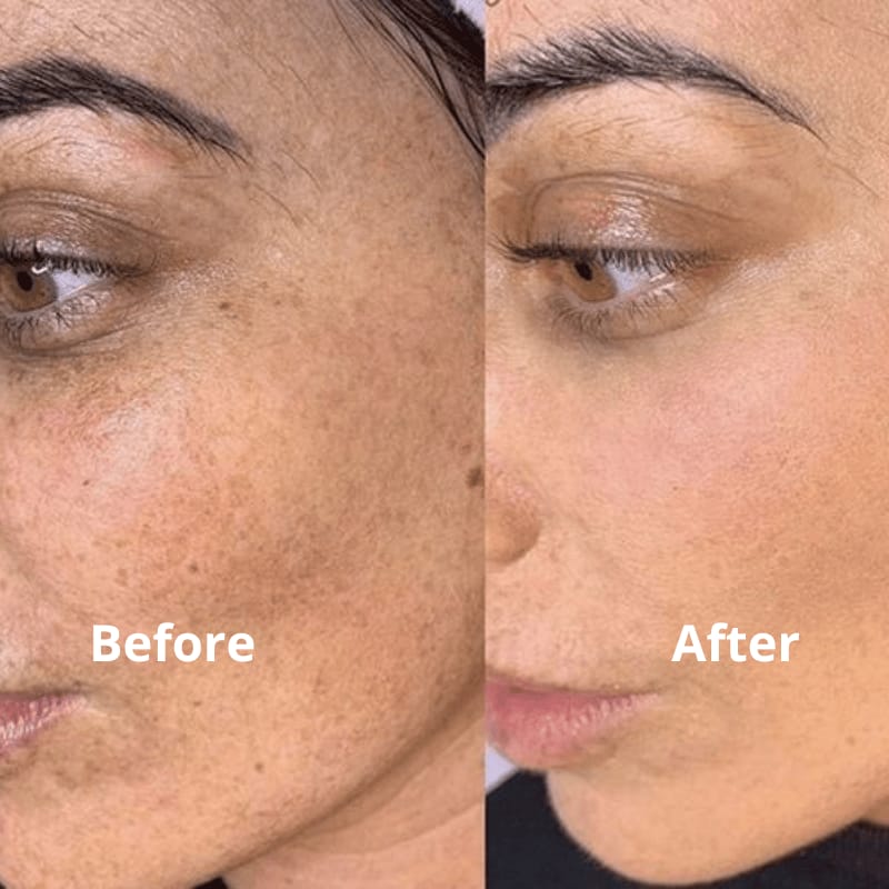 SPF 50+ PA++++ Broad-Spectrum UV Protection Sunscreen