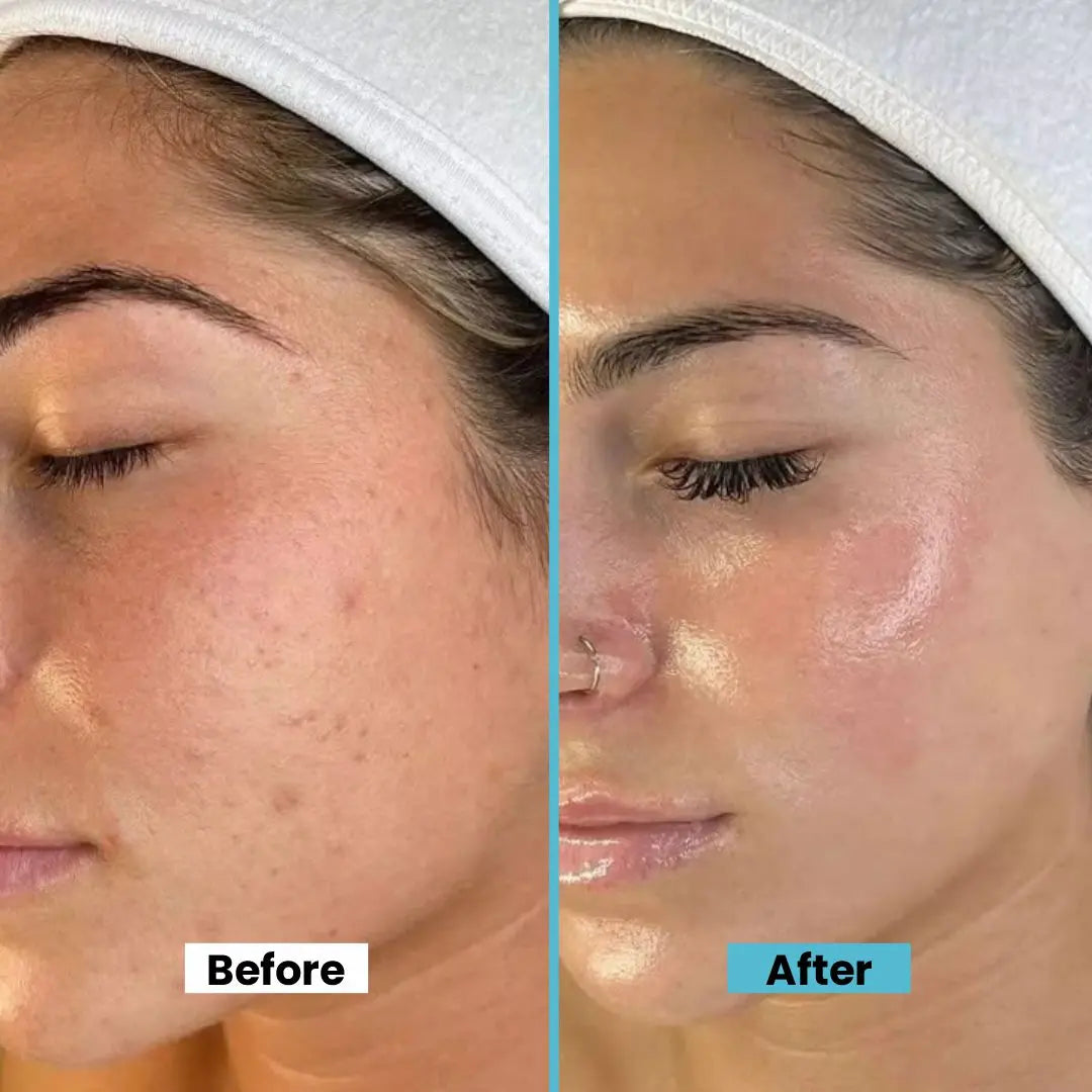 2% Hyaluronic Acid + Panthenol Hydrating Serum
