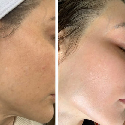 7% Glycolic Acid Resurfacing + Brightening Toner