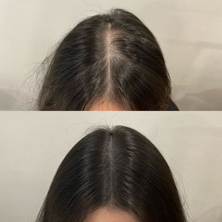 24-Ingredient & Scalp Nourishing Oil