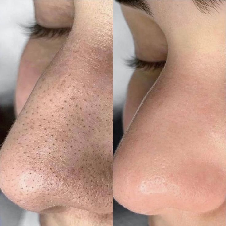 7% Glycolic Acid Resurfacing + Brightening Toner