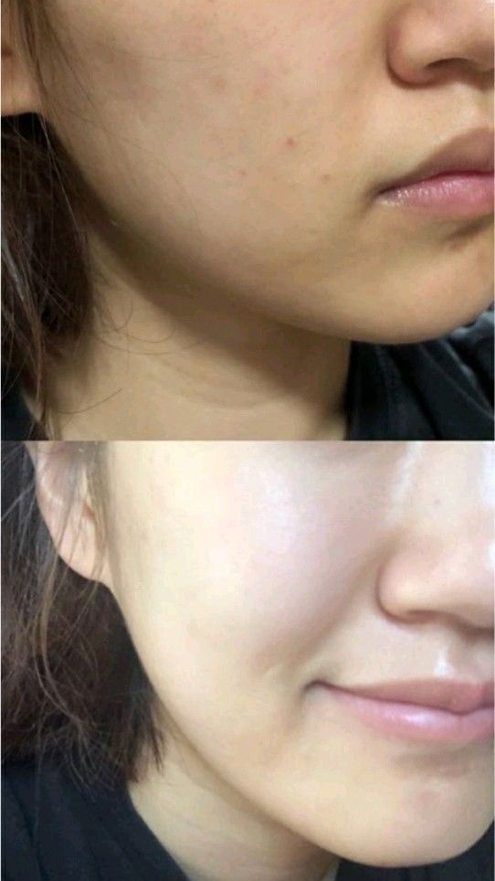 7% Glycolic Acid Resurfacing + Brightening Toner